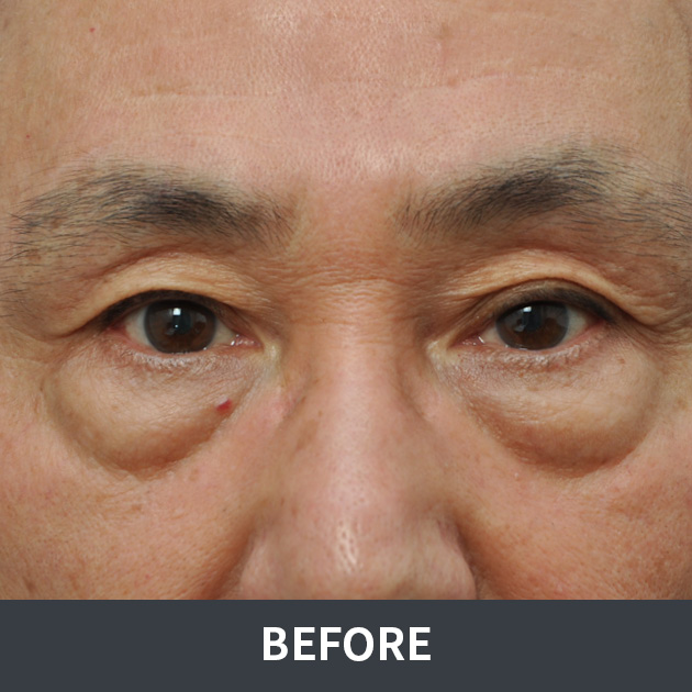 afterPhoto